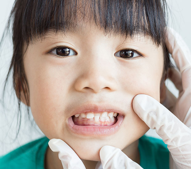 Asheville Root Canal Treatment